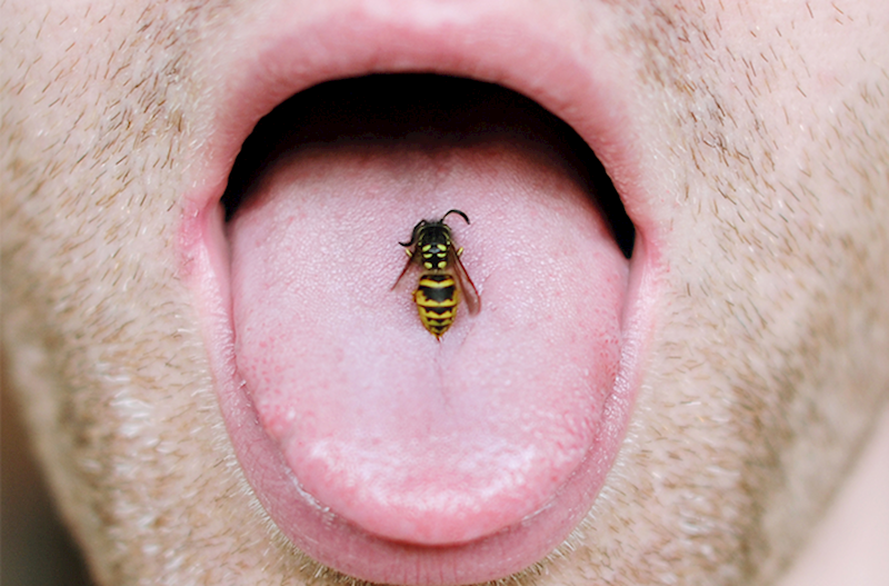 dilden-ari-sancmasi-esas